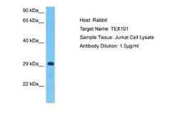 TEX101 Antibody, Novus Biologicals 100 &mu;L; Unconjugated:Antibodies,